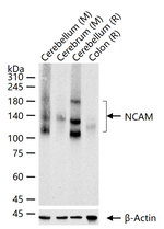 CD56 Antibody in Western Blot (WB)