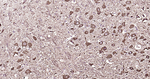 NF-H Antibody in Immunohistochemistry (Paraffin) (IHC (P))