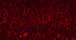 NF-H Antibody in Immunohistochemistry (Paraffin) (IHC (P))