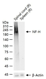 NF-H Antibody in Western Blot (WB)