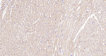 MYH6 Antibody in Immunohistochemistry (Paraffin) (IHC (P))