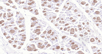 MYH6 Recombinant Rabbit Monoclonal Antibody (8C1)