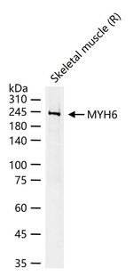 MYH6 Antibody in Western Blot (WB)