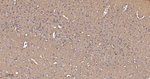 beta-2 Adrenergic Receptor Antibody in Immunohistochemistry (Paraffin) (IHC (P))