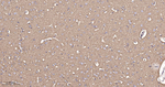 beta-2 Adrenergic Receptor Antibody in Immunohistochemistry (Paraffin) (IHC (P))