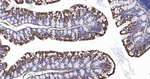 beta-2 Adrenergic Receptor Antibody in Immunohistochemistry (Paraffin) (IHC (P))