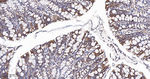 beta-2 Adrenergic Receptor Antibody in Immunohistochemistry (Paraffin) (IHC (P))