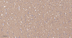 beta-2 Adrenergic Receptor Antibody in Immunohistochemistry (Paraffin) (IHC (P))