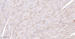 beta-2 Adrenergic Receptor Antibody in Immunohistochemistry (Paraffin) (IHC (P))