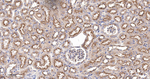 beta-2 Adrenergic Receptor Antibody in Immunohistochemistry (Paraffin) (IHC (P))
