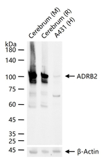 beta-2 Adrenergic Receptor Antibody in Western Blot (WB)