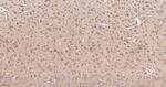 CHOP Antibody in Immunohistochemistry (Paraffin) (IHC (P))