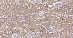 CHOP Antibody in Immunohistochemistry (Paraffin) (IHC (P))