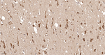 CHOP Antibody in Immunohistochemistry (Paraffin) (IHC (P))