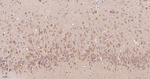 CHOP Antibody in Immunohistochemistry (Paraffin) (IHC (P))