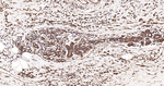 CHOP Antibody in Immunohistochemistry (Paraffin) (IHC (P))