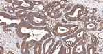CHOP Antibody in Immunohistochemistry (Paraffin) (IHC (P))