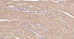 CHOP Antibody in Immunohistochemistry (Paraffin) (IHC (P))