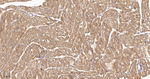 CHOP Antibody in Immunohistochemistry (Paraffin) (IHC (P))
