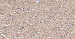ATP Synthase beta Antibody in Immunohistochemistry (Paraffin) (IHC (P))