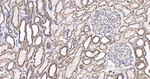 ATP Synthase beta Antibody in Immunohistochemistry (Paraffin) (IHC (P))
