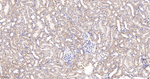 ATP Synthase beta Antibody in Immunohistochemistry (Paraffin) (IHC (P))