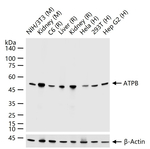 ATP Synthase beta Antibody in Western Blot (WB)