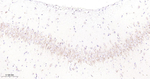 GBA Antibody in Immunohistochemistry (Paraffin) (IHC (P))