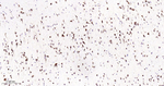 GBA Antibody in Immunohistochemistry (Paraffin) (IHC (P))