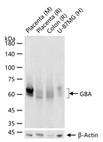 GBA Antibody in Western Blot (WB)