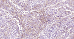 CD73 Recombinant Rabbit Monoclonal Antibody (2C9)