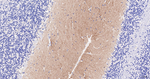 CD171 Antibody in Immunohistochemistry (Paraffin) (IHC (P))