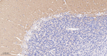 CD171 Antibody in Immunohistochemistry (Paraffin) (IHC (P))