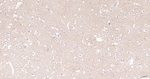 CD171 Antibody in Immunohistochemistry (Paraffin) (IHC (P))