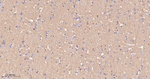 CD171 Antibody in Immunohistochemistry (Paraffin) (IHC (P))