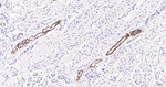 CD171 Antibody in Immunohistochemistry (Paraffin) (IHC (P))