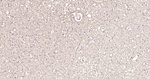 NF-M Antibody in Immunohistochemistry (Paraffin) (IHC (P))