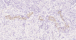 NF-M Antibody in Immunohistochemistry (Paraffin) (IHC (P))