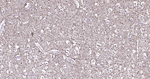 NF-M Antibody in Immunohistochemistry (Paraffin) (IHC (P))
