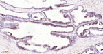 ADAM10 Recombinant Rabbit Monoclonal Antibody (4C3)