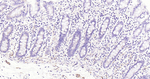 Podoplanin Antibody in Immunohistochemistry (Paraffin) (IHC (P))