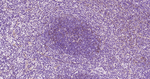 Podoplanin Antibody in Immunohistochemistry (Paraffin) (IHC (P))