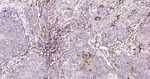 A2M Antibody in Immunohistochemistry (Paraffin) (IHC (P))