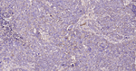 A2M Recombinant Rabbit Monoclonal Antibody (1C6)