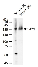 A2M Antibody in Western Blot (WB)