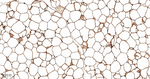 FABP4 Antibody in Immunohistochemistry (Paraffin) (IHC (P))