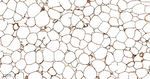 FABP4 Antibody in Immunohistochemistry (Paraffin) (IHC (P))