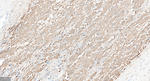 FGF21 Recombinant Rabbit Monoclonal Antibody (7C4)