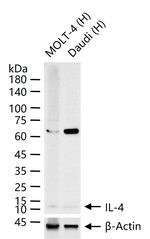 IL-4 Antibody in Western Blot (WB)