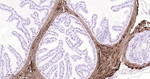 MYH11 Antibody in Immunohistochemistry (Paraffin) (IHC (P))